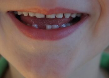 Ideas para la llegada del ratoncito pérez